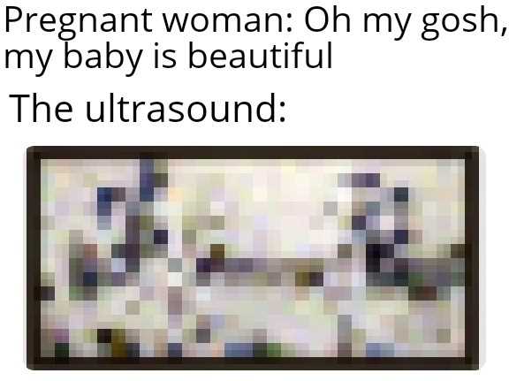 there is a picture of a woman on my gosh, my baby is beautiful the ultrasound