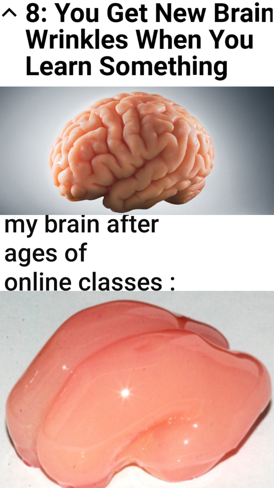 there are two pictures of a brain and a brain with a caption