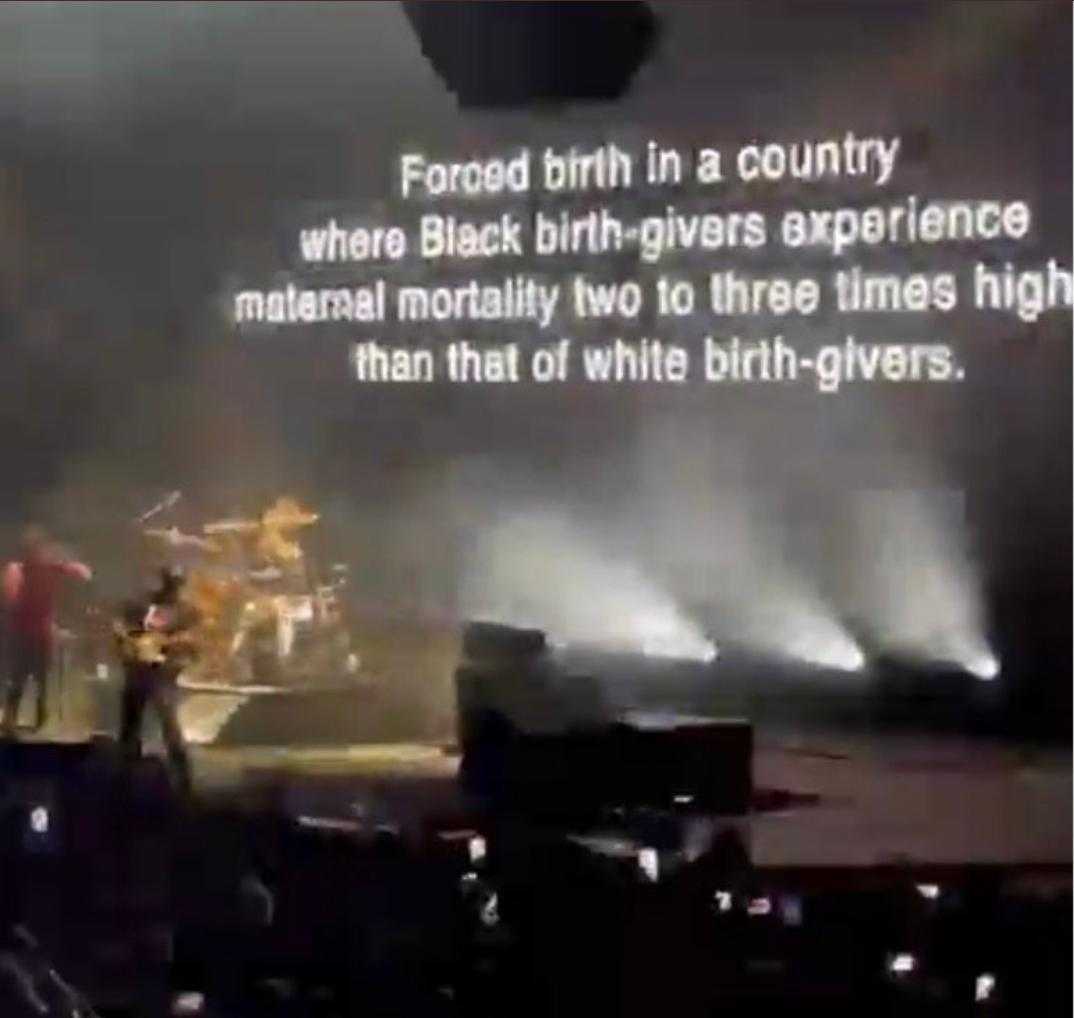 birth in a country where black birth gives experience metal mutilaty to the three times high than that white birth - givers